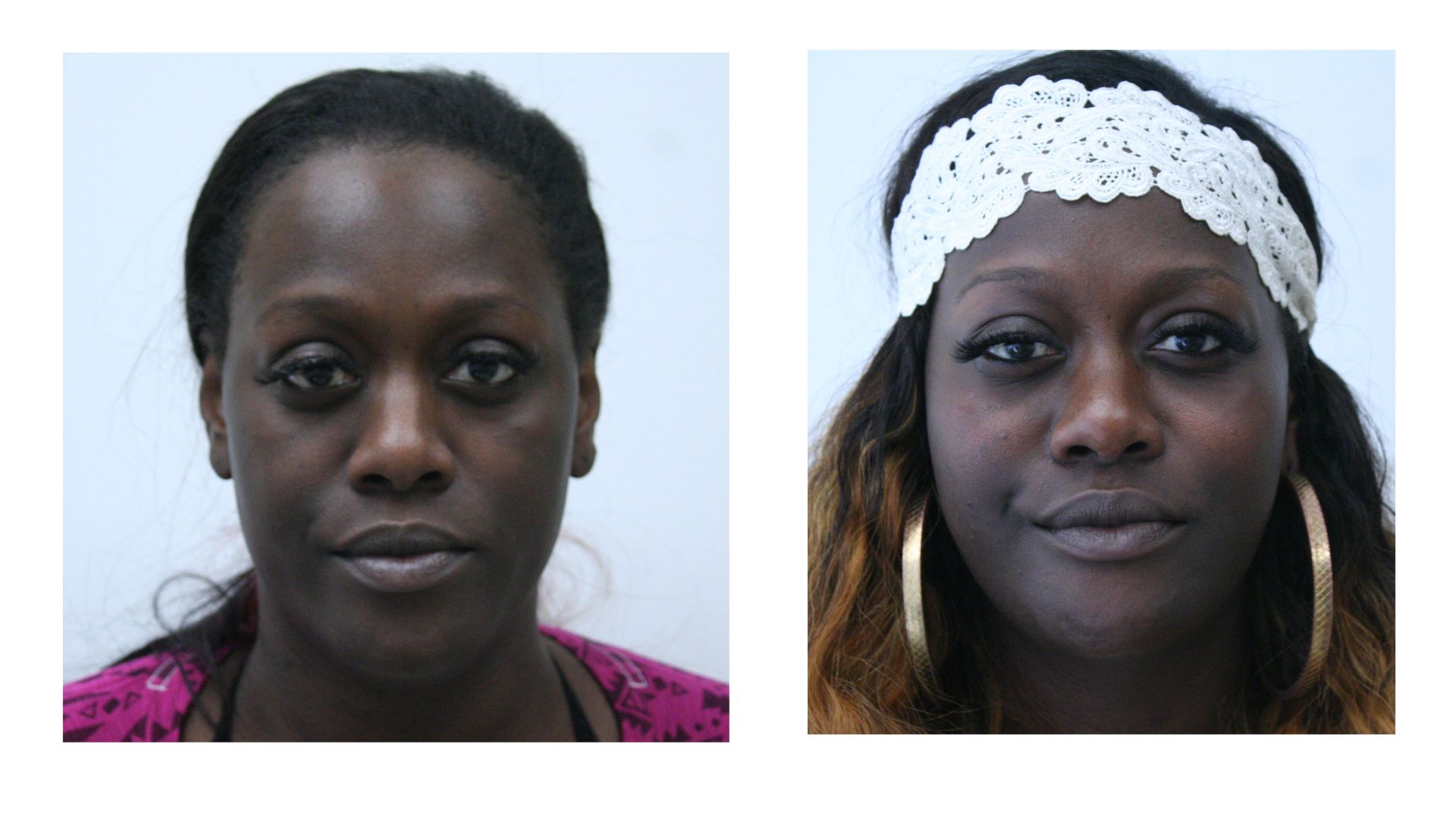 before & after of facial feminization surgery