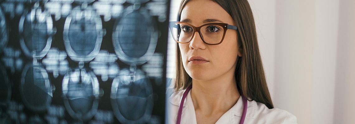 Doctor looking at brain scans