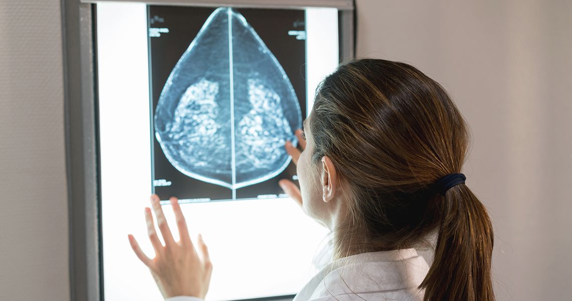 Doctor looking at breast scan