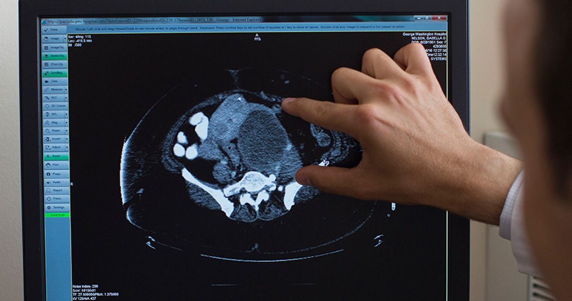 Doctor looking at a scan on a monitor