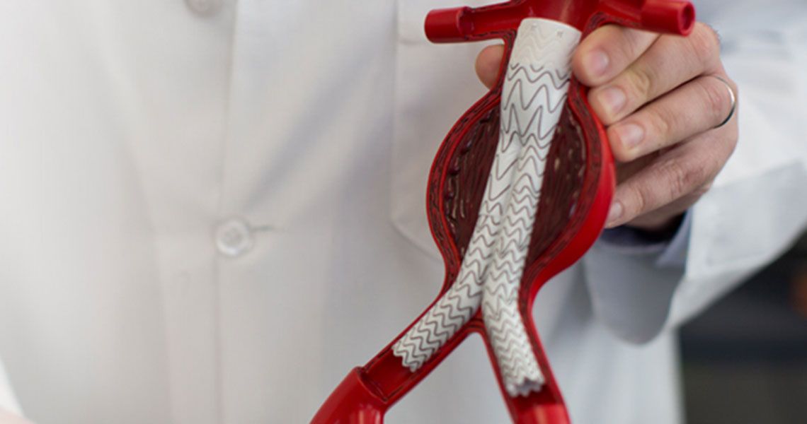 A doctor holding a model of veins