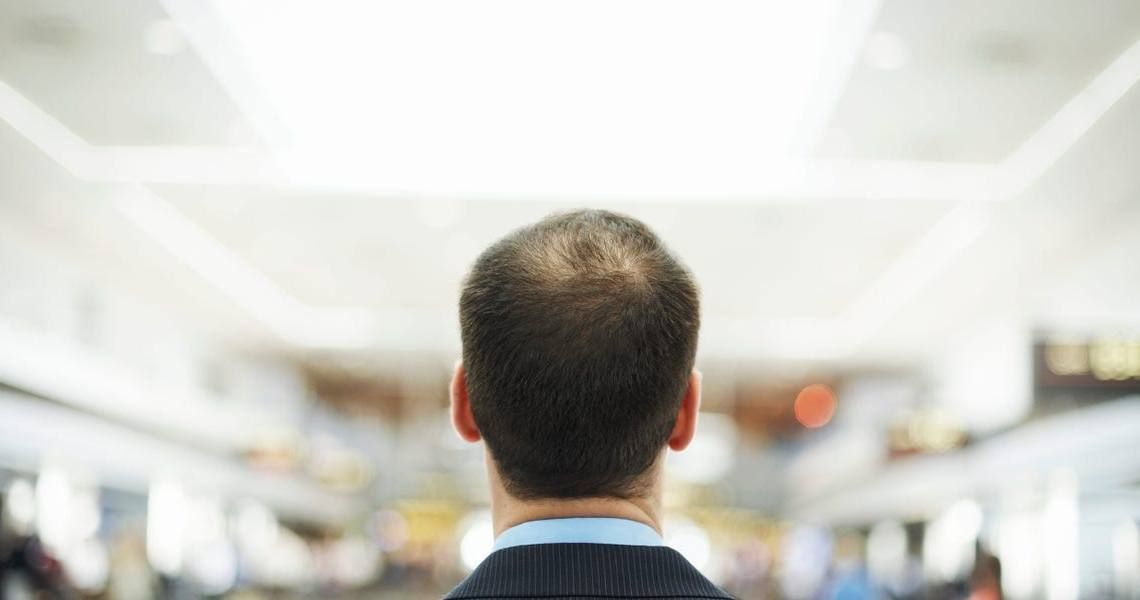 man with thinning hair