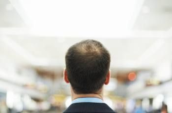man with thinning hair